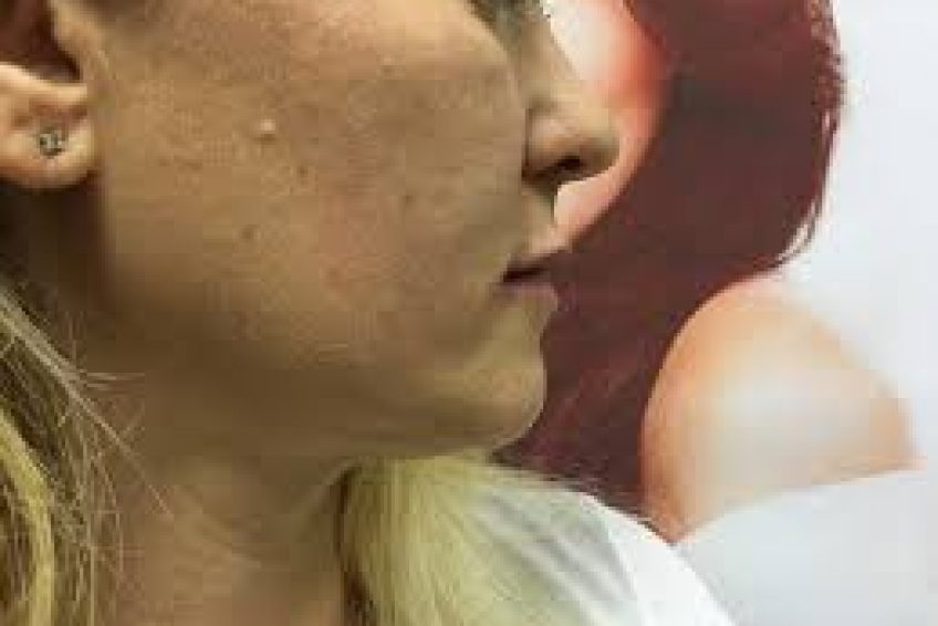 images-