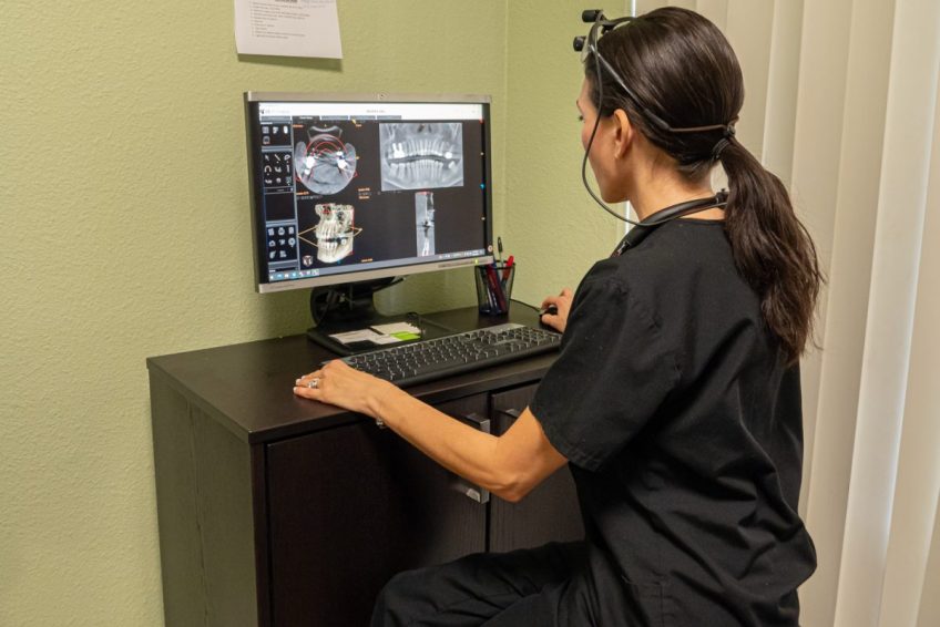 san jose dental implants