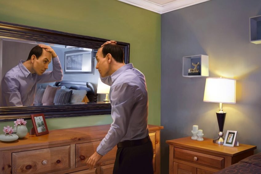 Hair Transplant Near Las Vegas